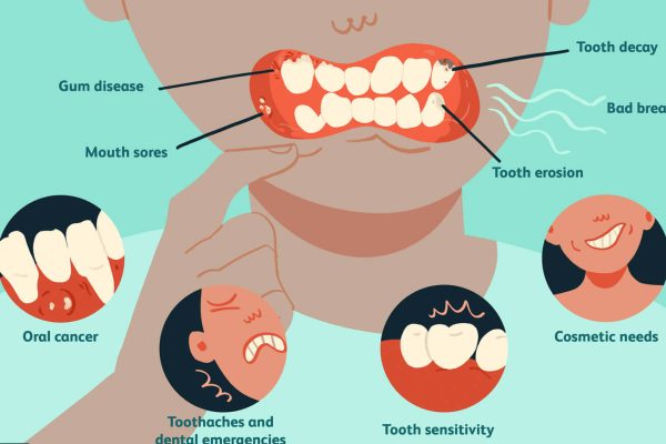 بیماری های بدن و سلامت دهان 