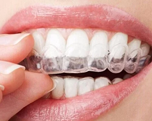 محافظ دندان